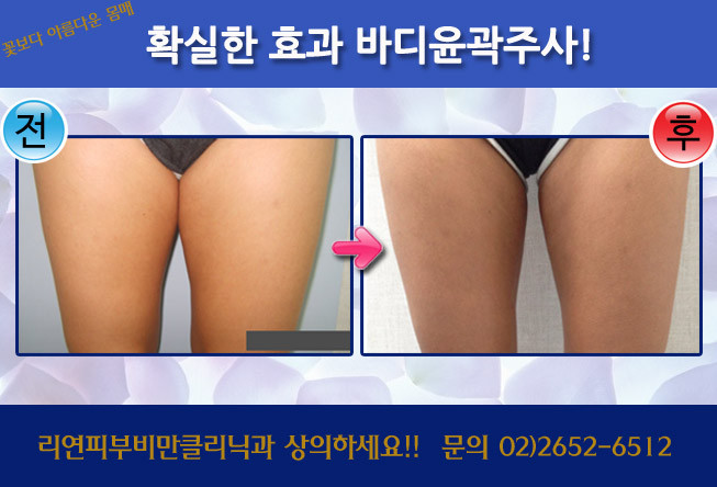 리연클리닉 바디윤곽주사