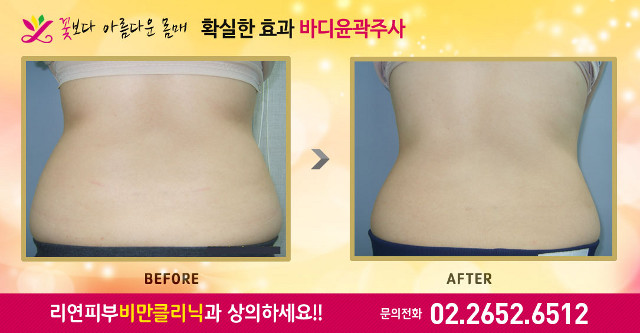 리연클리닉 전후사진