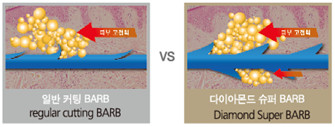 다이아몬드리프팅차이