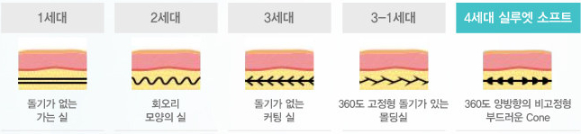 실리프팅의 진화 실루엣소프트