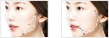 실루엣소프트 심술보 마리오넷부위