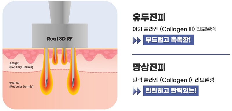 더블타이트