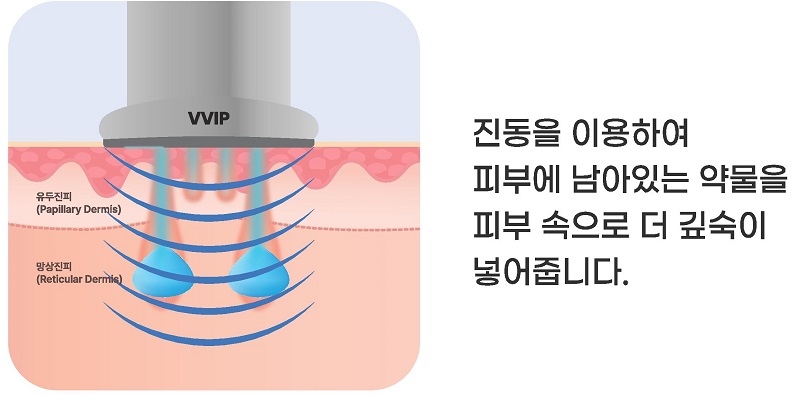 더블타이트