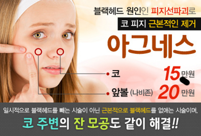 아그네스레이저 블랙헤드 코피지 코모공 치료