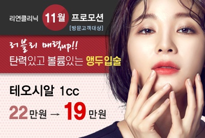 리연의원 테오시알필러 이벤트